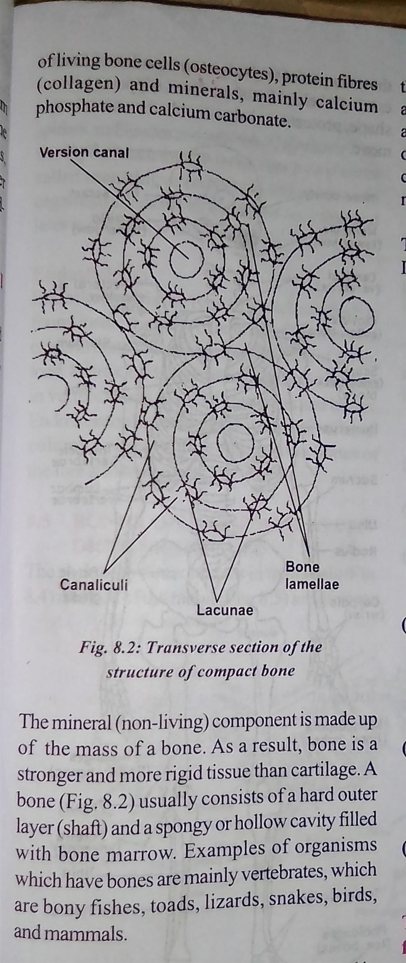 Bone is composed of A. Living cells, protein fibers, and calcium salts B. Living cells-example-2