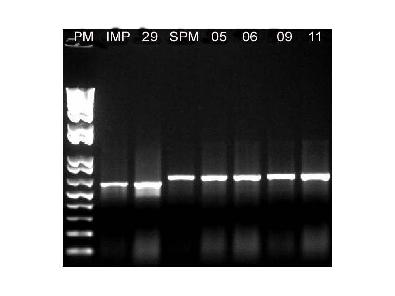 You first use PCR to amplify the fragment so that there is sufficient DNA for sequencing-example-2