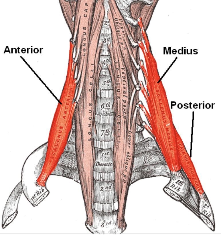 Which muscle originates on the transverse processes of the cervical vertebra and inserts-example-1