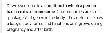 What is Down syndrome-example-1