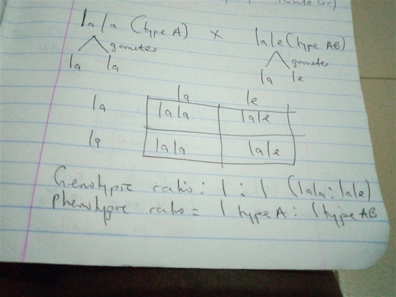 5. Assume that blood type is inherited as A and B dominant over O, but A and B are-example-1