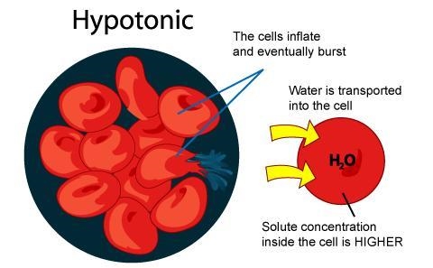 Hospital patients often receive medications, nutrients, and water intravenously (IV-example-1