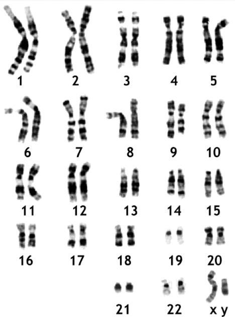 What was the diploid number for this individual-example-1