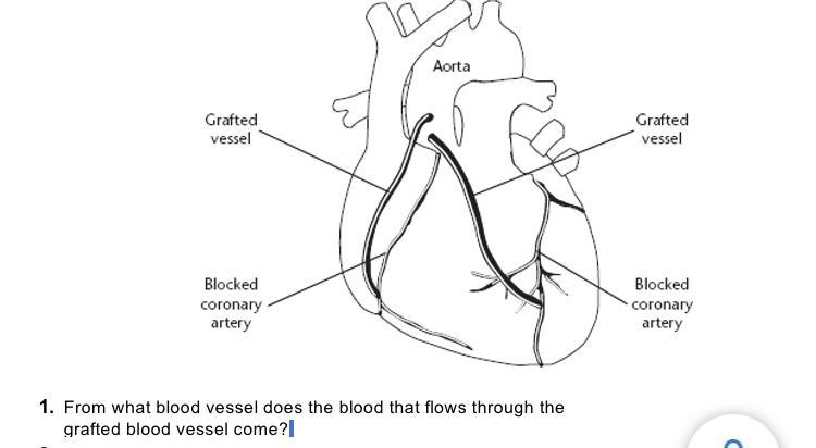 From what blood vessel does the blood that flows through the grafted blood vessel-example-1