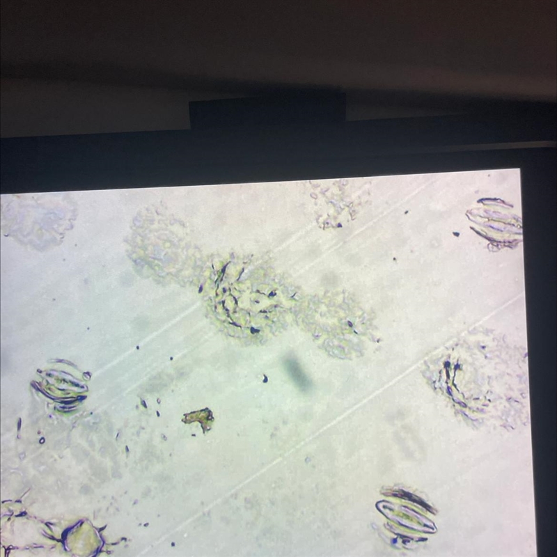 Are these three stomata opened or closed? if they are different, please tell me which-example-1