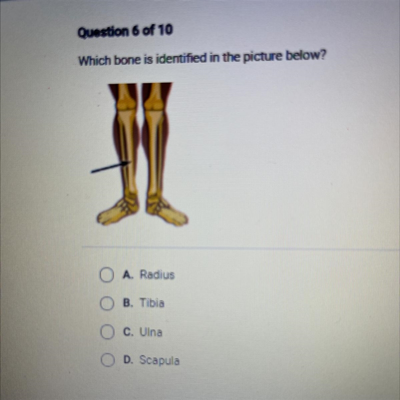 Which bone is identified in the picture below? O A. Radius OB. Tibia O C. Ulna O D-example-1