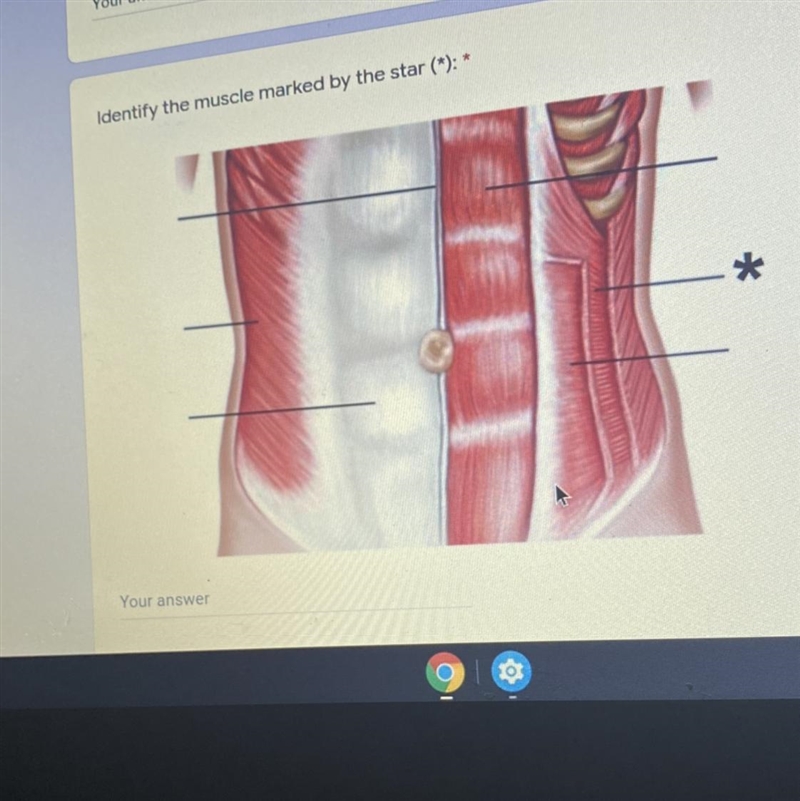 Identify the muscle marked by the star (*): * 27 points-example-1