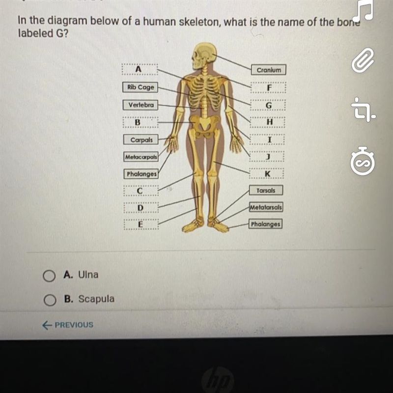 A. una b.scapula c.sterum d.clavicle-example-1