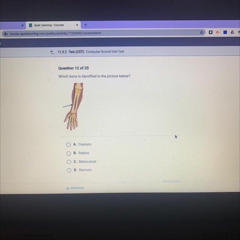 Which bone is identified in the picture below? O A. Cranium O B. Radius C. Metacarpal-example-1