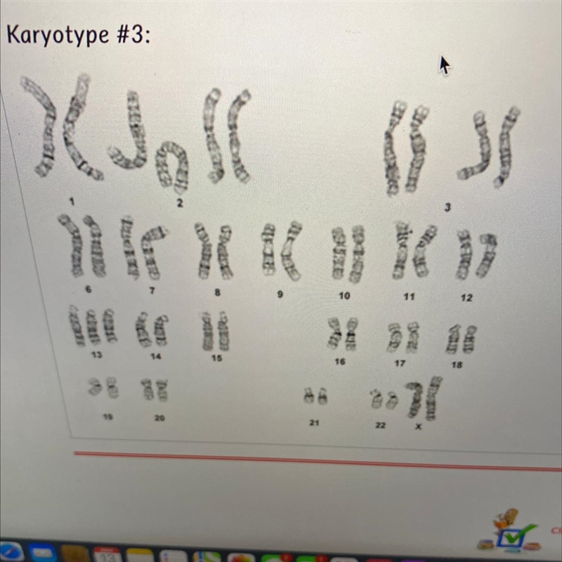 What type of syndrome is this Karyotype-example-1