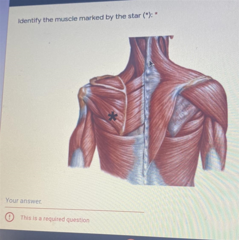 Identify the muscle marked by the star (*): * Your answer-example-1