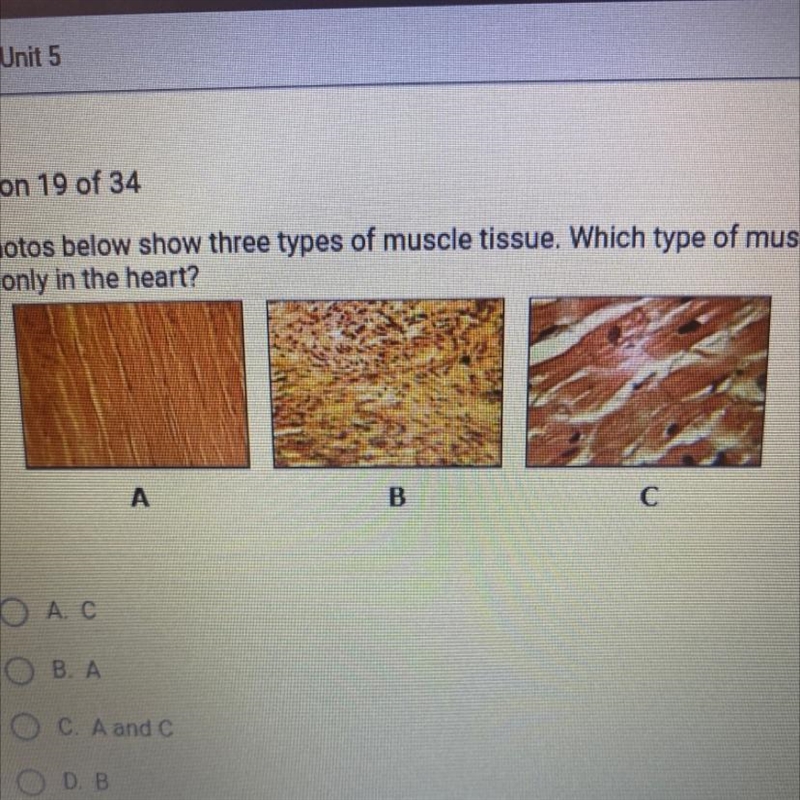 The photos below show three types of muscle tissue. Which type of muscle is found-example-1