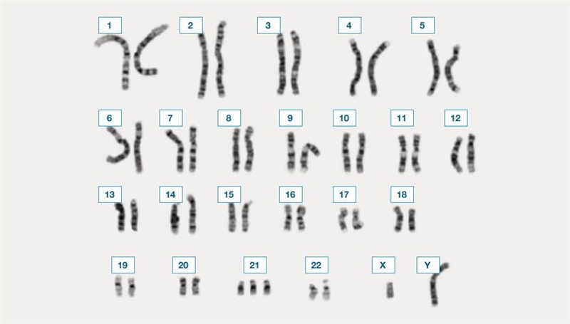 What would this chromosomal combination result in?-example-1