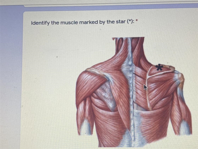 Identify the muscle marked by the star (*): *-example-1