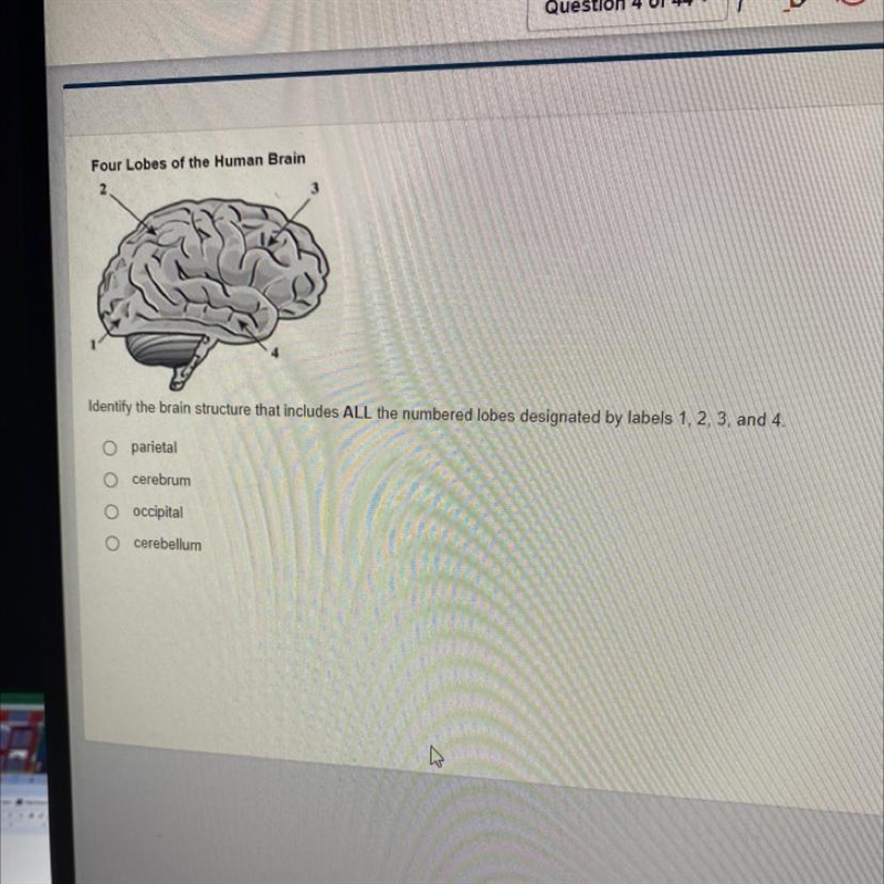 Identify the brain structure that includes ALL the numbered lobes designated by labels-example-1