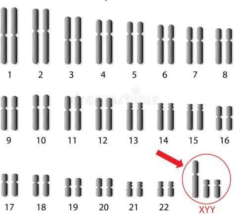 The karyotype below depicts a mutation on chromosome #23. What type of mutation is-example-1