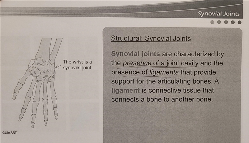 Which classification of joints has a joint cavity and ligaments to provide support-example-2