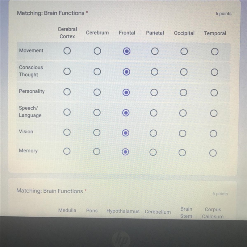 Matching: Brain Functions-example-1