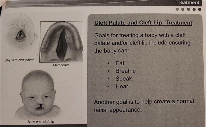 When treating a baby with cleft lip and/or palate, the goal is to ensure the baby-example-2