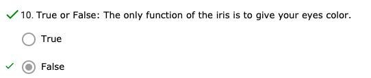 The ONLY function of the iris is to give your eyes color. True or *False-example-2