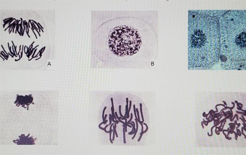 Which of the images below shows the phase during which DNA replicates itself? ​-example-1