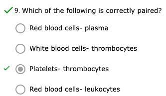 Which of the following is correctly paired?-example-1