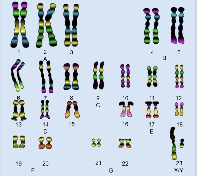 Please help and no file What is activity A title? Count: Chromosomes 1 through 22 are-example-1