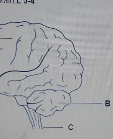 Damage to the brain can sometimes occur as the result of an accident. State the part-example-1