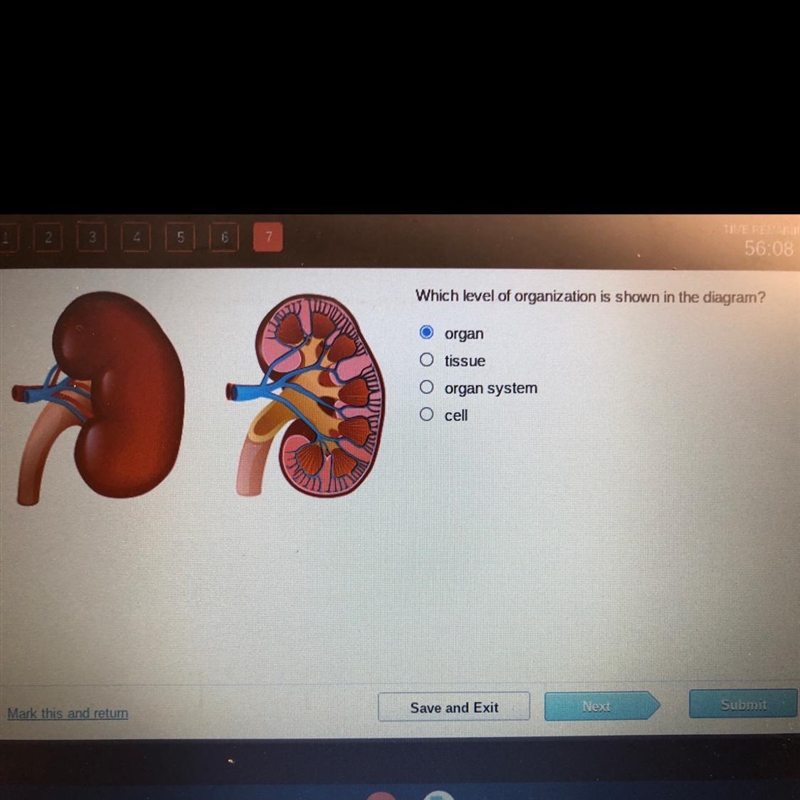 Which level of organization is shown in the diagrarn? organ 0 tissue organ system-example-1