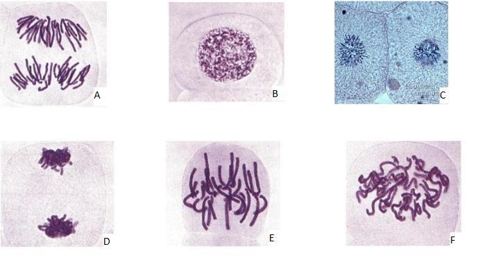 Which phase of the cell cycle is shown in image A-example-1