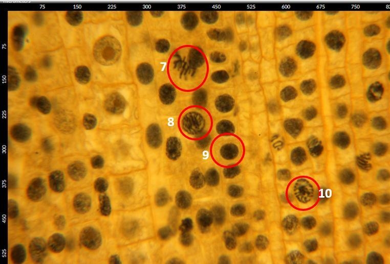 I NEED HELP IDENTIFYING THE STEPS OF MITOSIS!!! PLZ HELP THIS IS DUE TODAY-example-3