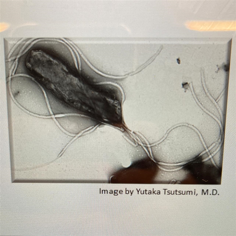 What is shown in the image? A. Prokaryote B. Eukaryote C. Chloroplast D. Mitochondrion-example-1