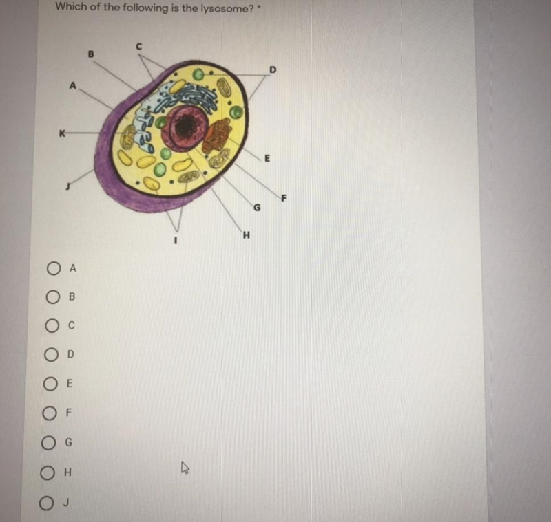 Which of the following is the lysosome?-example-1