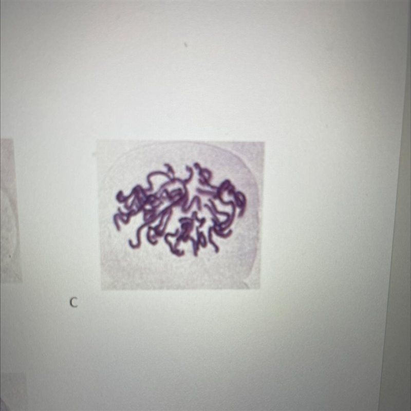 Which phase is being shown in image C?-example-1