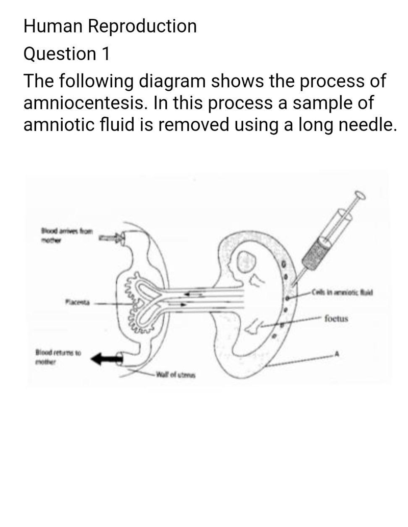 What is A? plsssss helppppp​-example-1