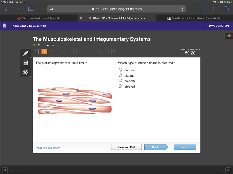 The picture represents muscle tissue. Which type of muscle tissue is pictured?-example-1