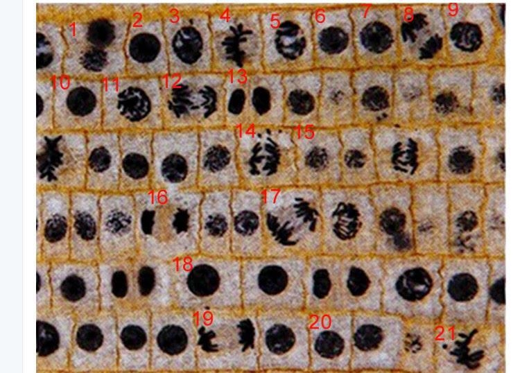 What stage is represented by the cells with the dark circles?-example-1