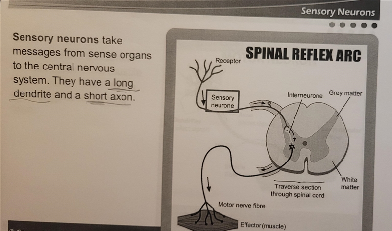 Which of the following has a short dendrite and a long axon?-example-3