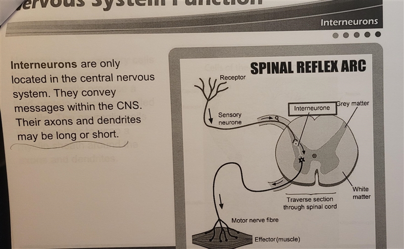 Which of the following has a short dendrite and a long axon?-example-4