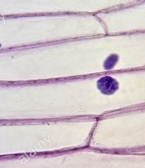 Label the parts of the onion cell.​-example-1