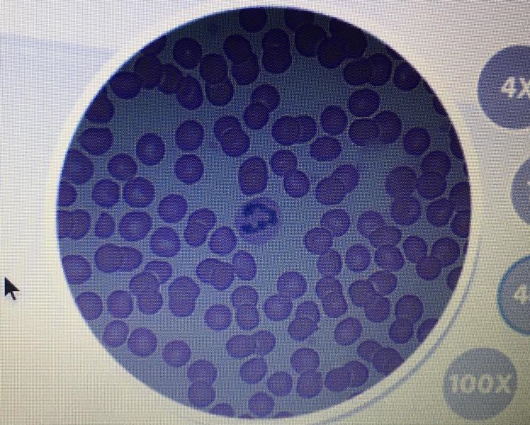 Hey y’all, how many human blood cells are in the circle pls help I can’t count lol-example-1