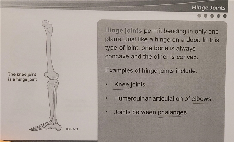 Which of the following is a __________? Interphalangeal joint Elbow joint Tibiofemoral-example-2