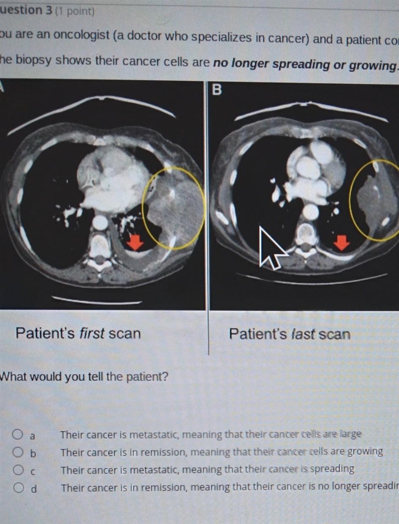 What would you tell the patient? ​-example-1