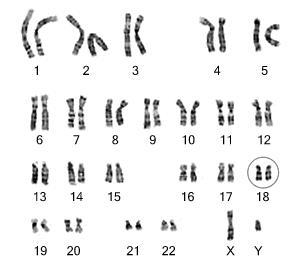 How are karyotypes made?-example-1