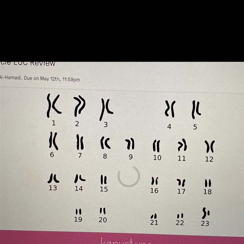 Of the 23 pairs of chromosomes in the human body, how many pairs are homologous? A-example-1