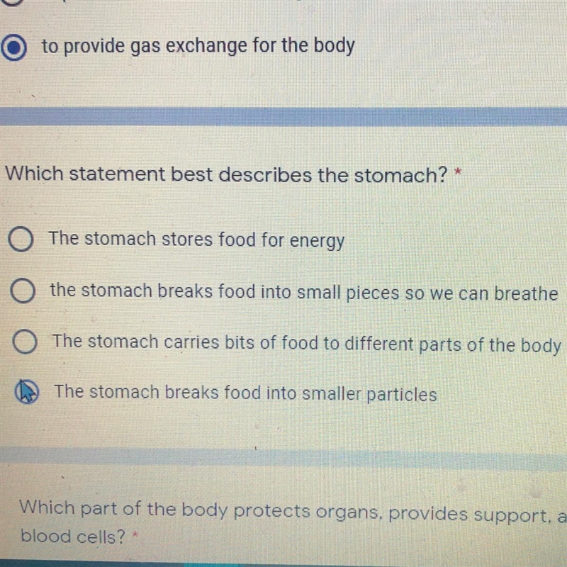 Which statement best describes the stomach?-example-1