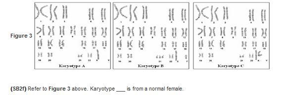 Biology need help asap-example-2