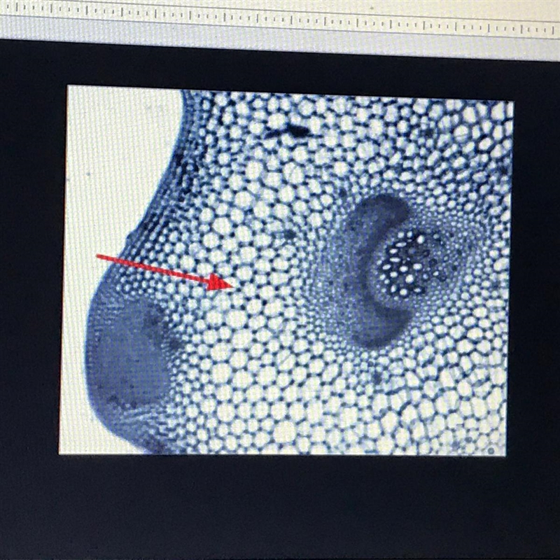 What is this plant tissue?-example-1