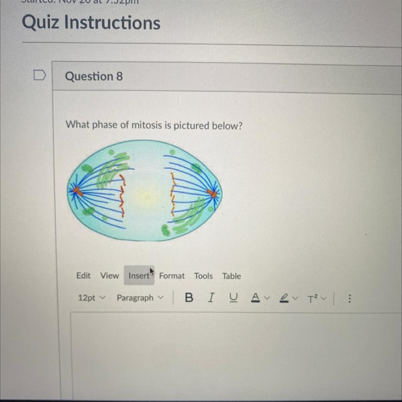 What phase of mitosis is pictured below?-example-1