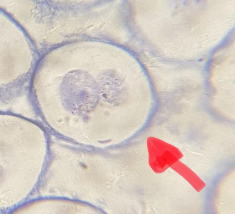 Is this telophase of cytokinesis?-example-1